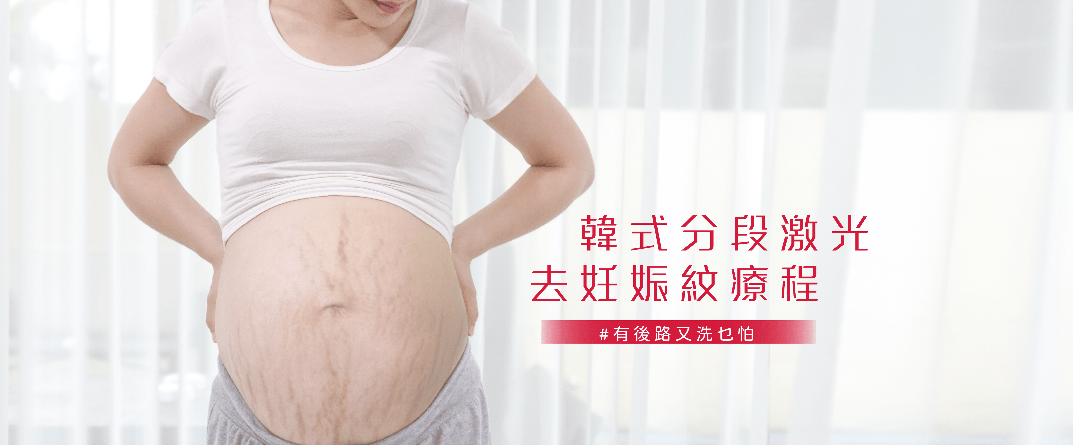 激光去妊娠紋療程